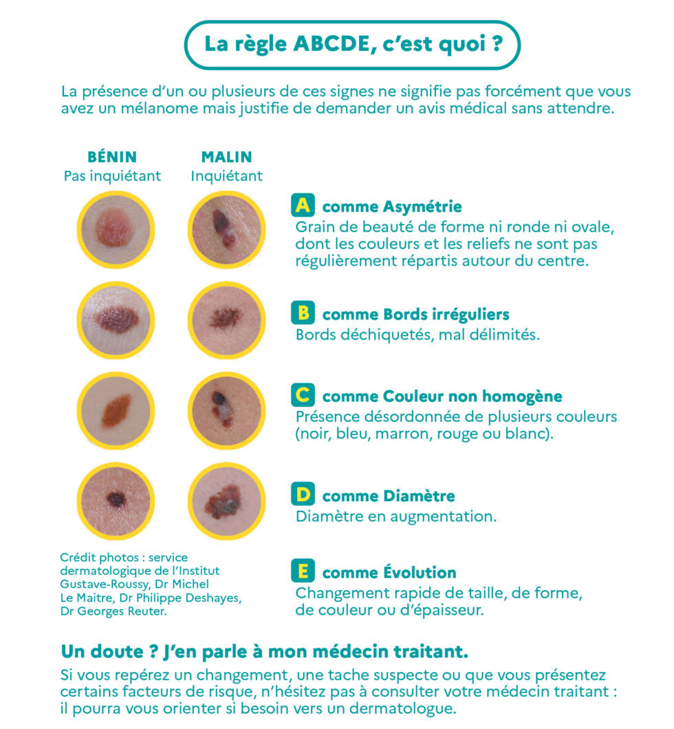 Enjeu du dépistage du cancer de la peau